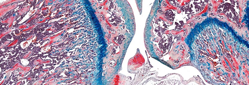 Easing Your Transformation to a Digital Workflow