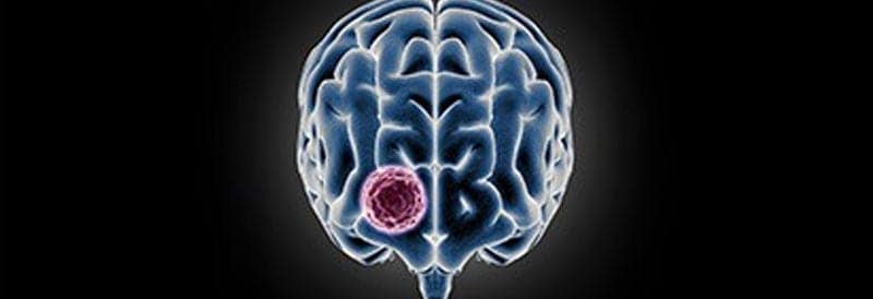 Immunotherapy for Glioblastoma Treatment