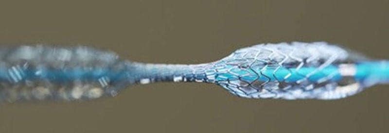 Mastering Flexibility with Nitinol - The Shape-Memory Wonder