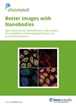 Bessere Bilder mit Nanobodies